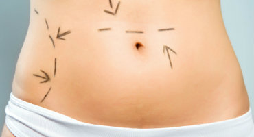 tummy types - small